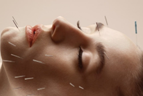 COSMETIC ACUPUNCTURE
